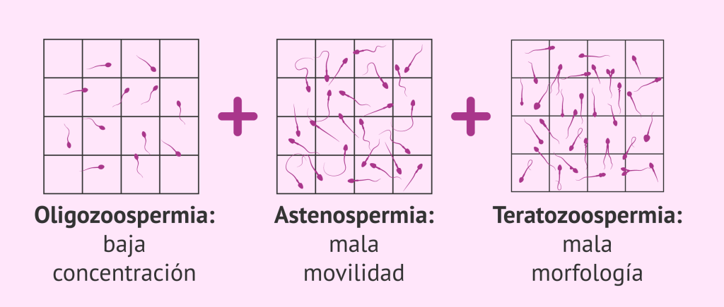 Entérate qué es la «Oligoastenoteratospermia» y cómo se trata