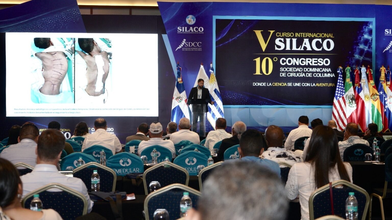 Especilistas realizan 347 cirugías de escoliosis pediátrica en los últimos cuatro años